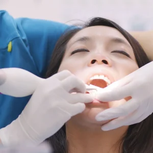 Dental Scaling